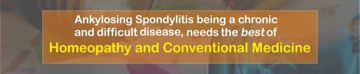 Homeopathic Treatment for Ankylosing Spondylitis