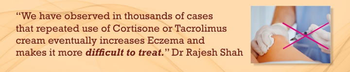 Homeopathy for Eczema