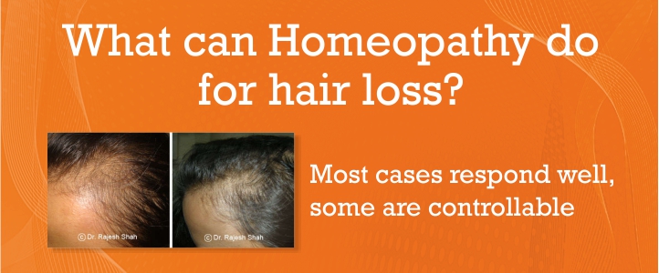 Pin on Homeopathy Hair Care Products