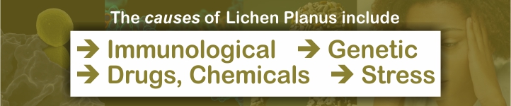 causes of lichen planus