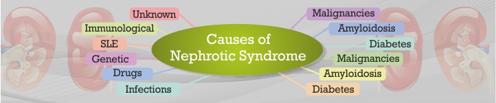Symptoms of Nephrotic Syndrome