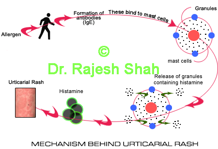 Mechanism Behind Urticaria Rash