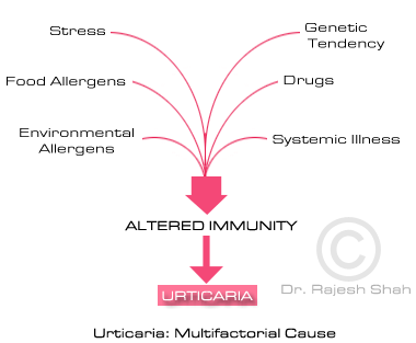 Causes of Urticaria