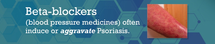 Homeopathy treatment for Psoriasis