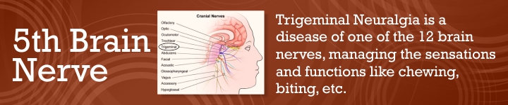 Best Treatment for Trigeminal Neuralgia