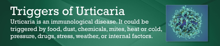 Cure for urticaria