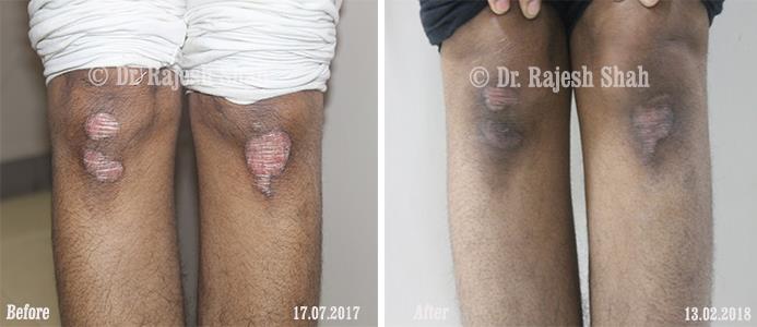 lifeforce homeopathy case-photos