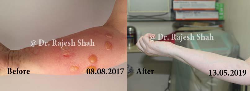 lifeforce homeopathy case-photos