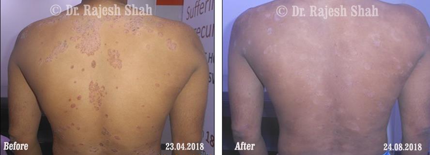 lifeforce homeopathy case-photos