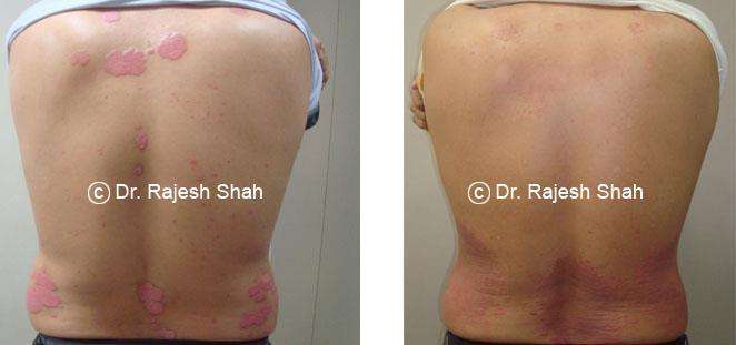 lifeforce homeopathy case-photos