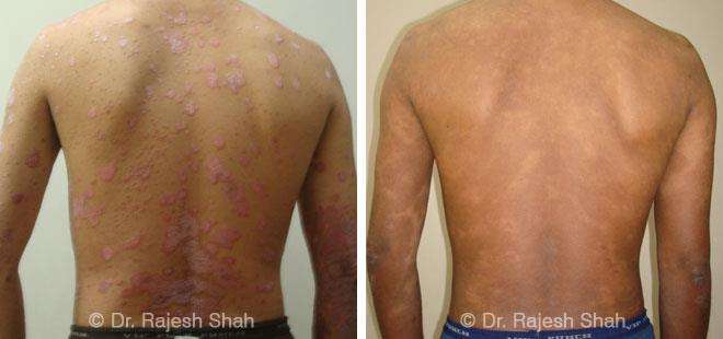 lifeforce homeopathy case-photos