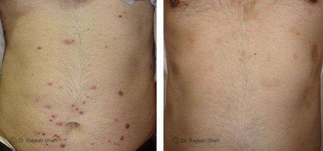 lifeforce homeopathy case-photos