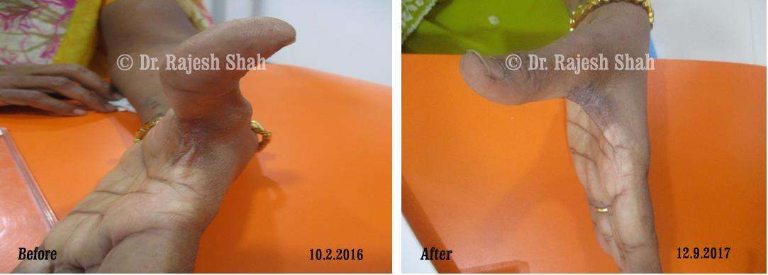 lifeforce homeopathy case-photos