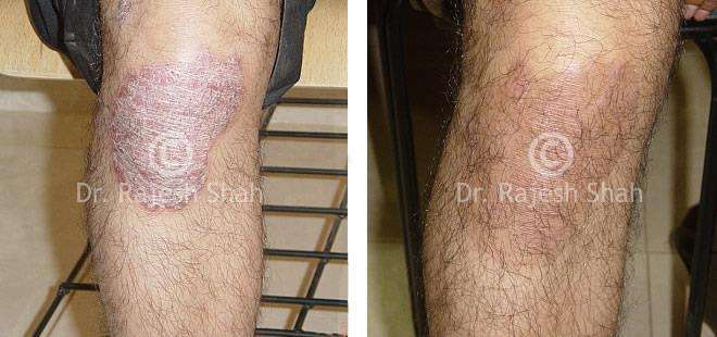lifeforce homeopathy case-photos