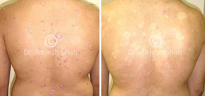lifeforce homeopathy case-photos