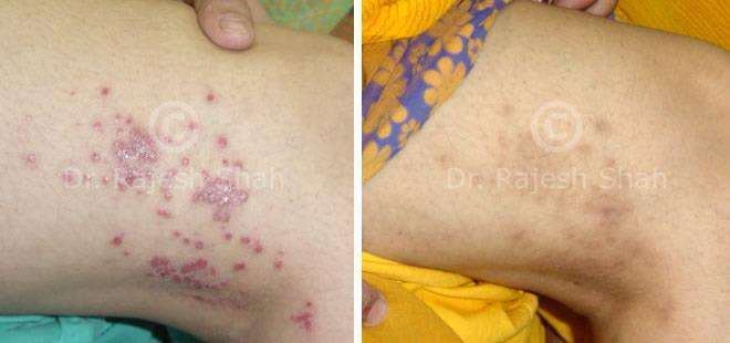 lifeforce homeopathy case-photos
