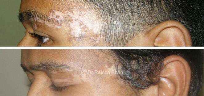 lifeforce homeopathy case-photos