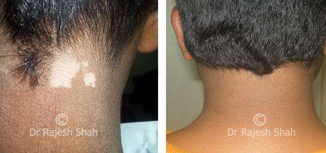 lifeforce homeopathy case-photos