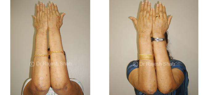 lifeforce homeopathy case-photos