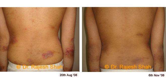 lifeforce homeopathy case-photos
