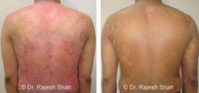 lifeforce homeopathy case-photos