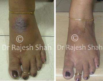 lifeforce homeopathy case-photos