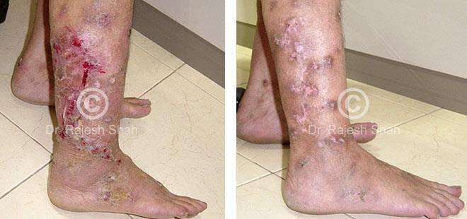 lifeforce homeopathy case-photos