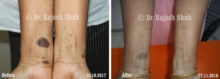 lifeforce homeopathy case-photos