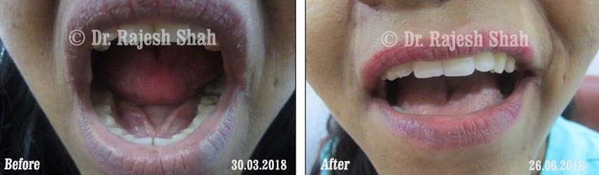 lifeforce homeopathy case-photos
