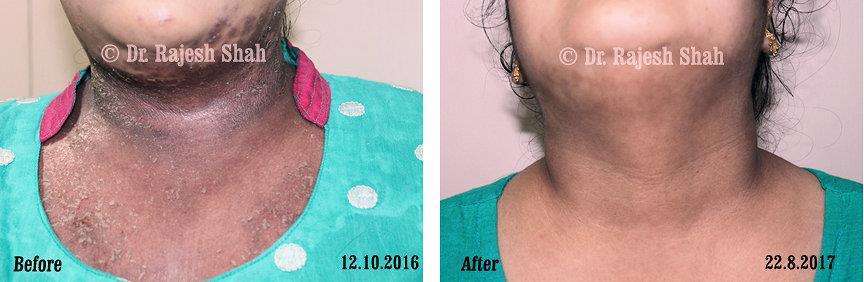 lifeforce homeopathy case-photos