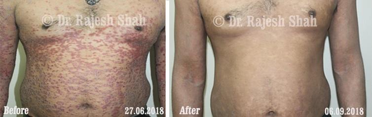 lifeforce homeopathy case-photos