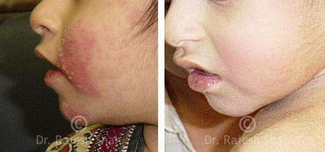 lifeforce homeopathy case-photos