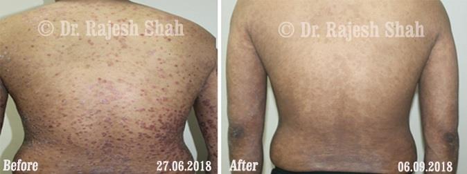 lifeforce homeopathy case-photos