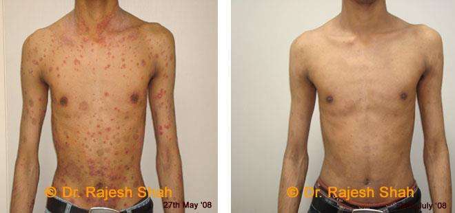 lifeforce homeopathy case-photos