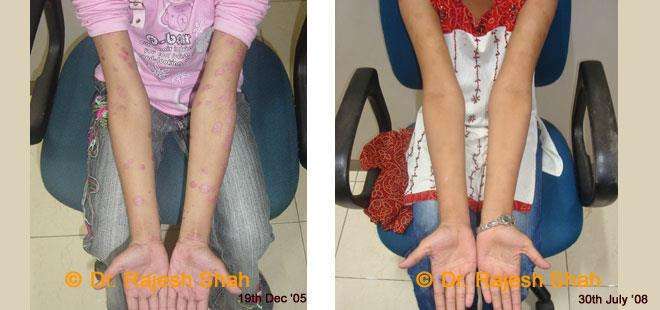lifeforce homeopathy case-photos