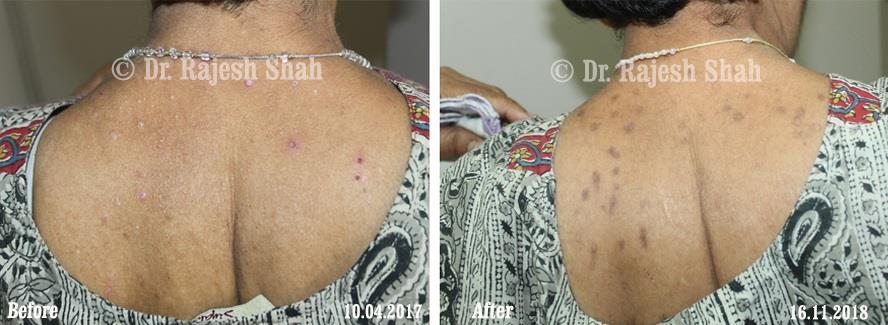 lifeforce homeopathy case-photos