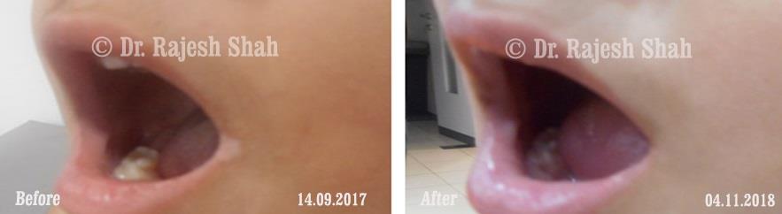 lifeforce homeopathy case-photos
