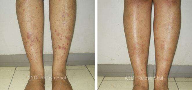 lifeforce homeopathy case-photos