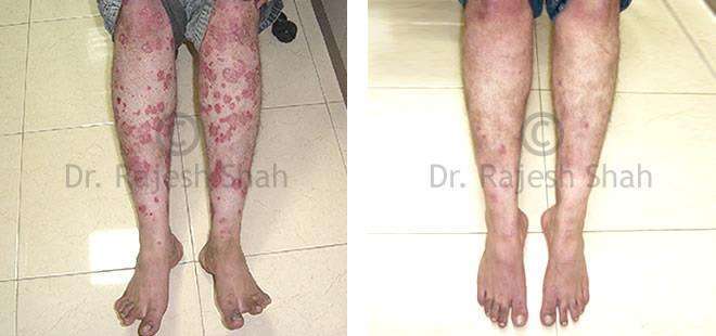 lifeforce homeopathy case-photos
