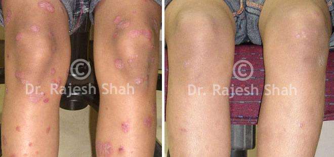 lifeforce homeopathy case-photos