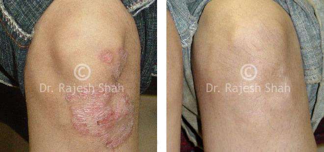 lifeforce homeopathy case-photos