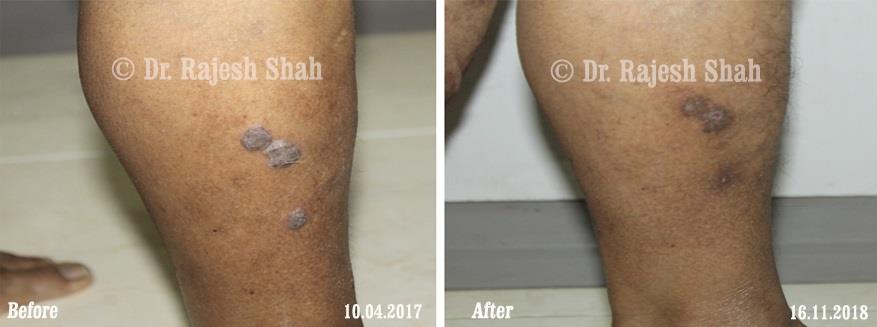 lifeforce homeopathy case-photos