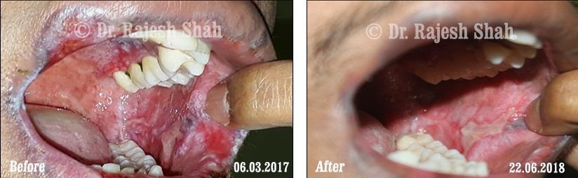 lifeforce homeopathy case-photos