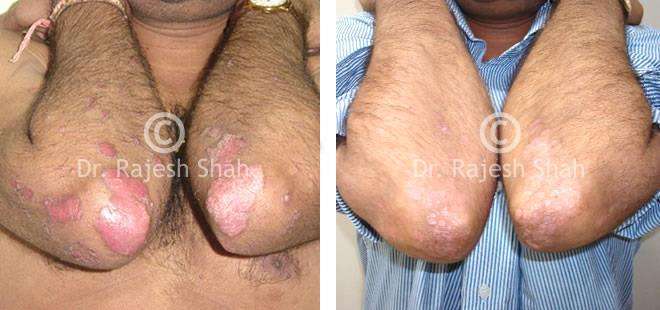 lifeforce homeopathy case-photos