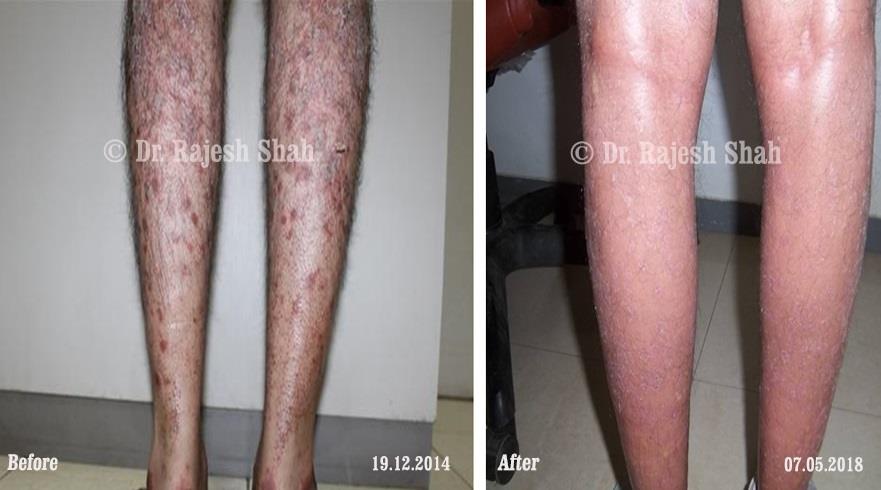 lifeforce homeopathy case-photos