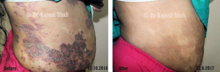 lifeforce homeopathy case-photos
