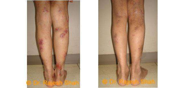 lifeforce homeopathy case-photos