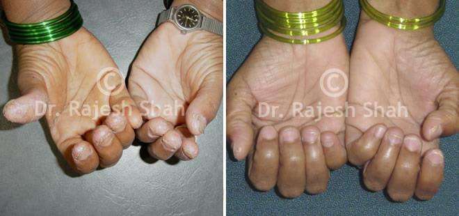 lifeforce homeopathy case-photos