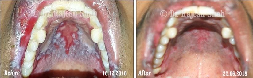 lifeforce homeopathy case-photos
