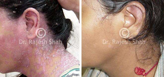 lifeforce homeopathy case-photos